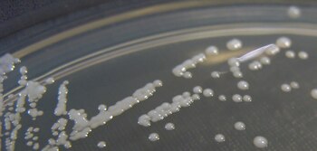 30/12/2012 Cultivo de 'Candida glabrata' en crecimiento
ESPA�A EUROPA MADRID SALUD
ATHAN READING, CON LICENCIA CREATIVE COMMONS