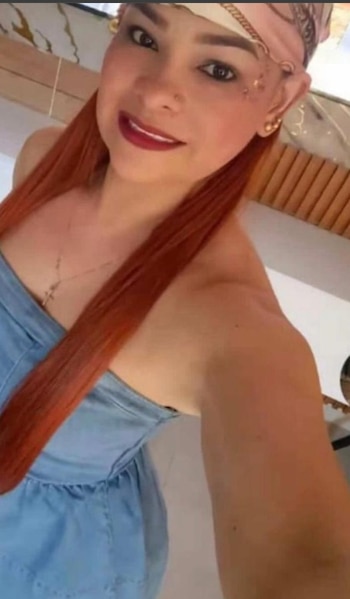 Yuleidis Fernanda Charris Reales, una mujer de 40 años, falleció el 6 de abril de 2026 tras someterse a una liposucción en una vivienda del barrio Las Nieves - crédito @EmisorasABC/X