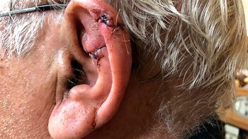 Oreja cosida por veterinario