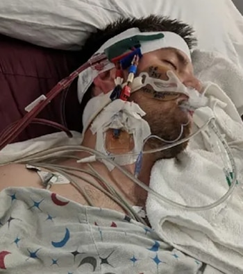 Un hombre acostado en una cama de hospital con tubos respiratorios, cables y parches médicos conectados a su rostro y cuello