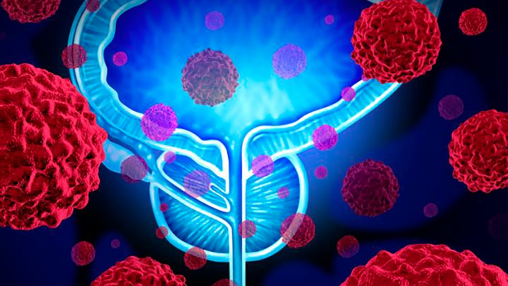 BQXKBJIWVRHYFEQWGH5TCROR5A