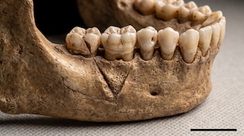 Una mandíbula humana fósil con dientes visibles, presenta una marca lineal en el hueso y el premolar inferior izquierdo, sobre una superficie clara con una regla de escala.
