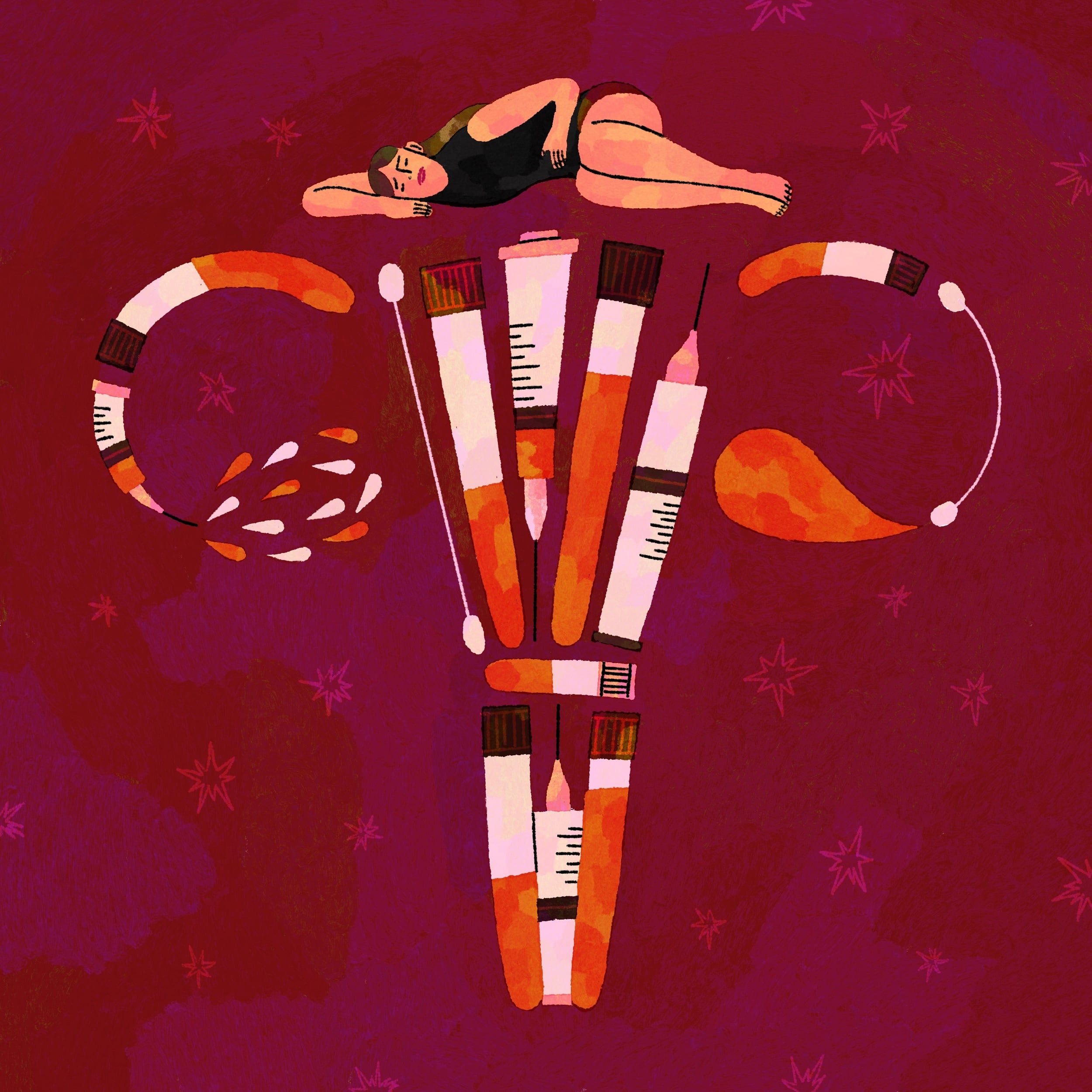 For many, a reliable noninvasive test to diagnose endometriosis feels like the holy grail. Now, several start-ups claim to have found it, offering to diagnose endometriosis by examining RNA molecules in saliva, proteins in blood, or electrical signals in the gastrointestinal tract. (Lorena Spurio/The New York Times) Ñ FOR EDITORIAL USE ONLY WITH NYT STORY SCI ENDOMETRIOSIS TESTS BY MAGGIE ASTOR FOR OCT. 4, 2026. ALL OTHER USE PROHIBITED. Ñ