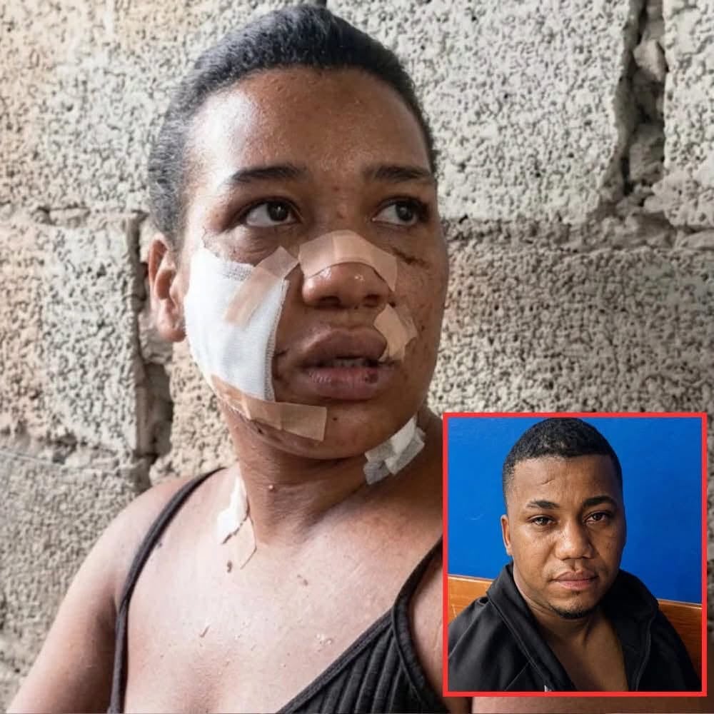 Nayely Capellán sobrevivió a un brutal ataque de 26 estocadas en Las Cabuyas, La Vega, un caso que reaviva el debate sobre la protección real a las víctimas.