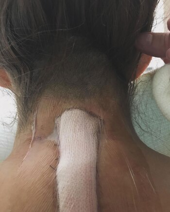 Lola fue operada por un