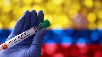 Hantavirus: no hay casos confirmados en Colombia, pero el Gobierno refuerza la vigilancia tras brote que dejó tres muertos en un crucero internacional