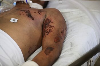 El Senado promueve un punto