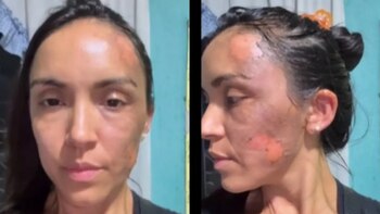 Una mujer denunció que fue atacada con agua hirviendo durante un partido de hockey infantil en Tucumán