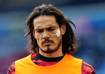 Cavani, con todo acordado para