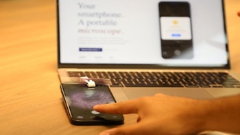Hem.IA utiliza inteligencia artificial para detectar patrones en muestras de sangre mediante un celular - Créditos: Gobierno del Perú.