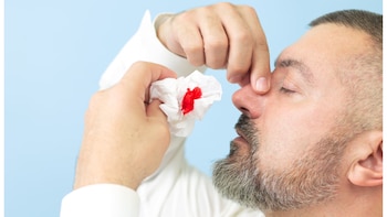 ¿Cuál es la relación entre los sangrados de la nariz y la presión alta?