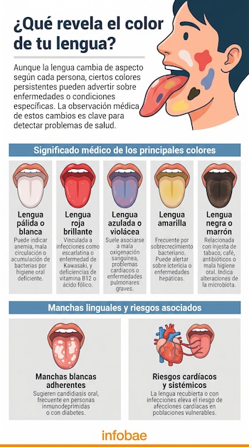 Infografía muestra un rostro de perfil con lengua de varios colores. Debajo, imágenes de lenguas pálidas, rojas, azules, amarillas, negras y con manchas, con un corazón.