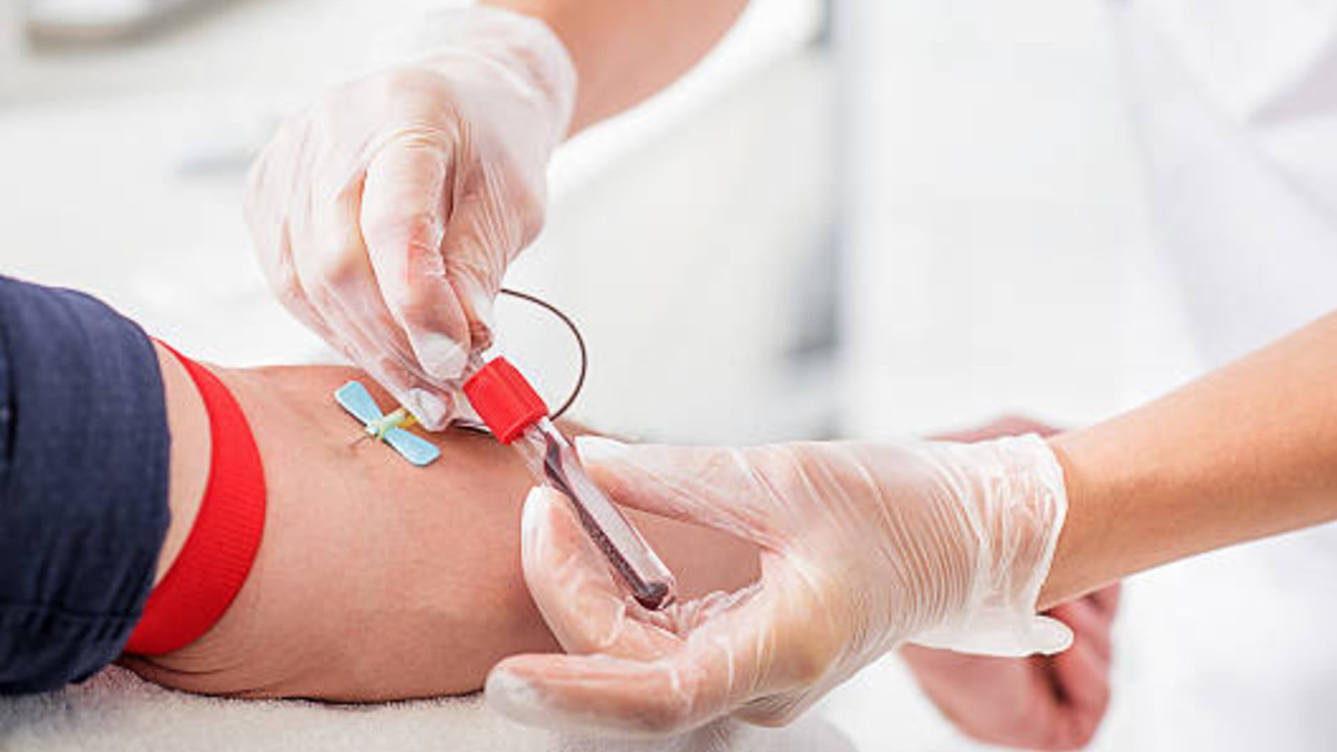 Congreso de Jalisco fortalece marco legal para garantizar abasto de sangre. Foto: (iStock)