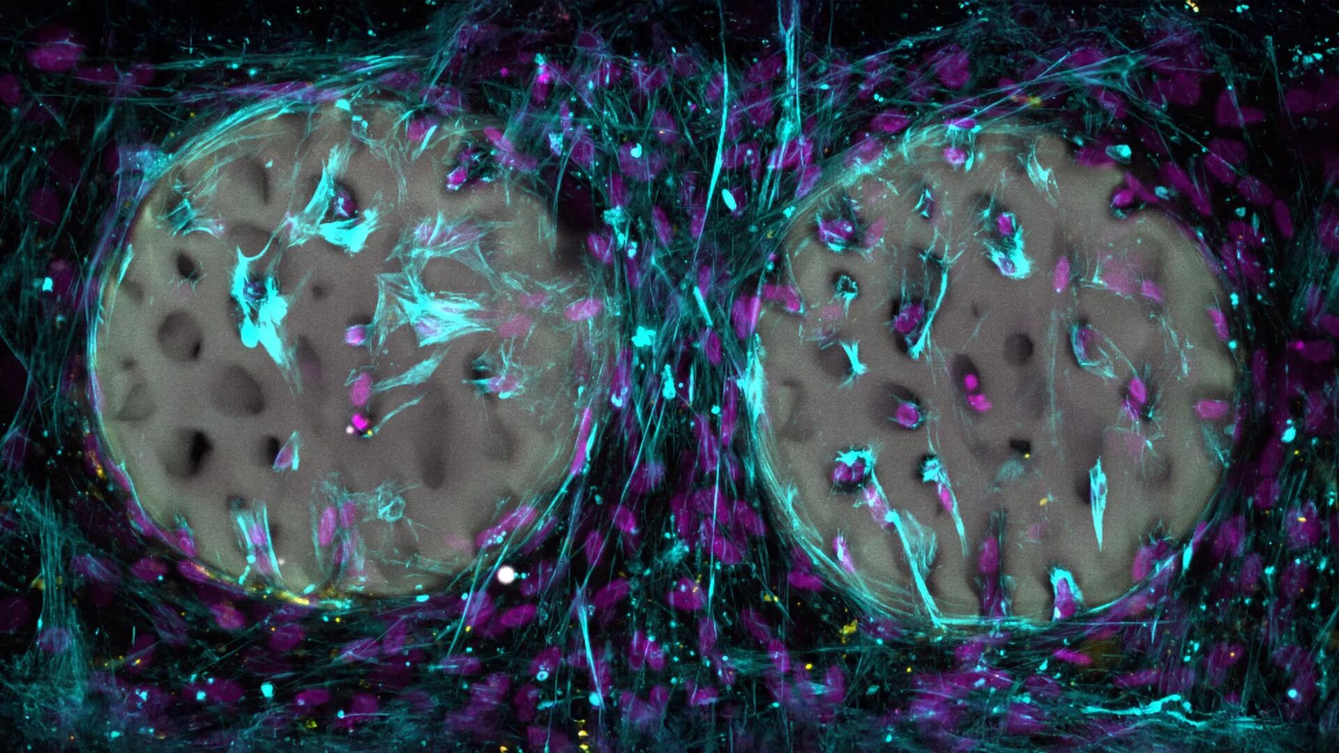En pruebas de laboratorio, las células formadoras de hueso migraron rápidamente al hidrogel y comenzaron a producir colágeno, clave en la regeneración ósea. (Crédito: Xiao-Shua Qin / ETH Zurich)