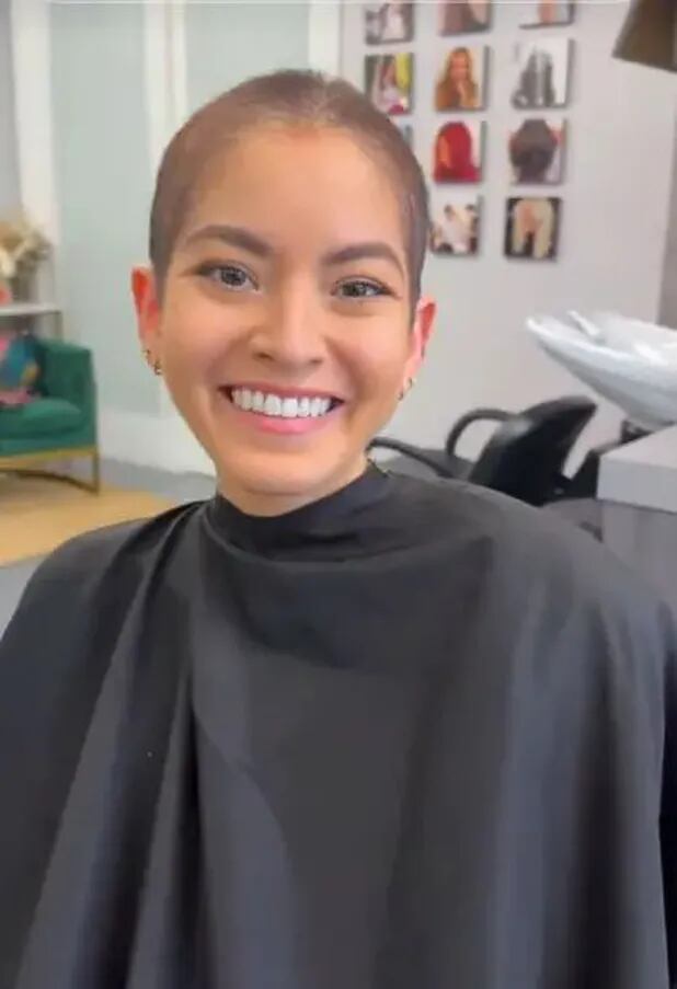 La creadora de contenido compartió en redes sociales cada etapa de su tratamiento, mostrando fortaleza y honestidad ante la adversidad (Instagram)