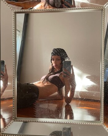 Una AVM cerebral es una