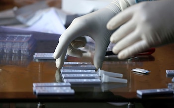 Los epidemiólogos alemanes realizarán “un