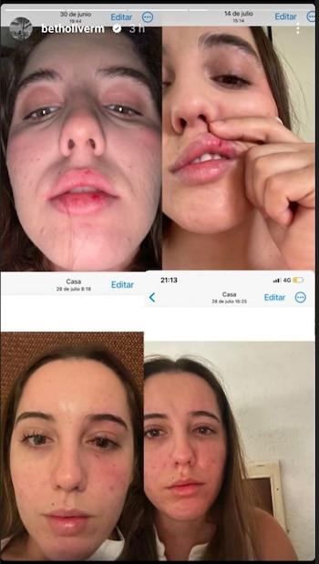 (Instagram / @betholiverm)