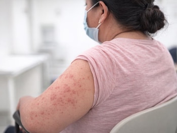 Equipos de vigilancia epidemiológica mantienen monitoreo sobre los contactos de la paciente. (FOTO: Secretaría de Salud)