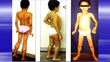 Los gemelos crecidos en forma