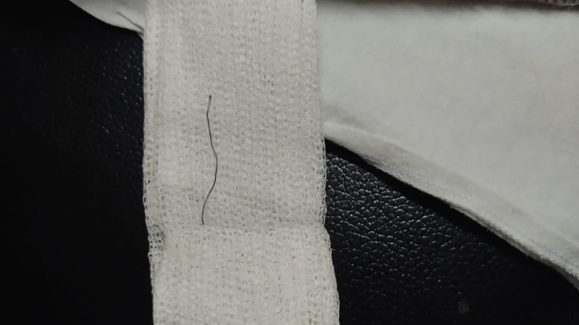 El hospital Materno Infantil de Mar del Plata halló mediante estudios por imágenes un alambre fino incrustado en la garganta del paciente (0223)