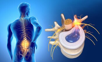 Este padecimiento ocurre en la