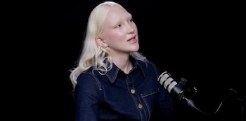 Un tumor desmoide obligó a Mila Morales a someterse a cirugías y tratamientos que cambiaron de forma irreversible el color de su piel y su cabello - crédito captura de video Vos podés, el pódcast / Youtube