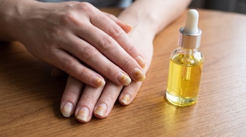 Un par de manos con uñas que presentan manchas amarillentas sobre una mesa de madera, con un frasco de aceite transparente con gotero.