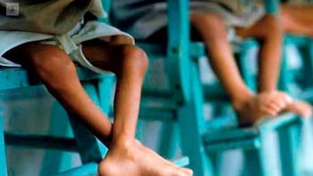La desnutrición infantil en Guatemala deja 11,241 casos agudos y 16 muertes en 2026
