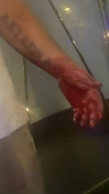 El brazo ensangrentado del sospechoso