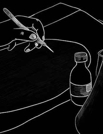 Una ilustración monocromática de una mano que sujeta un escalpelo o bisturí, una botella con tapa y un matraz cónico sobre una superficie negra