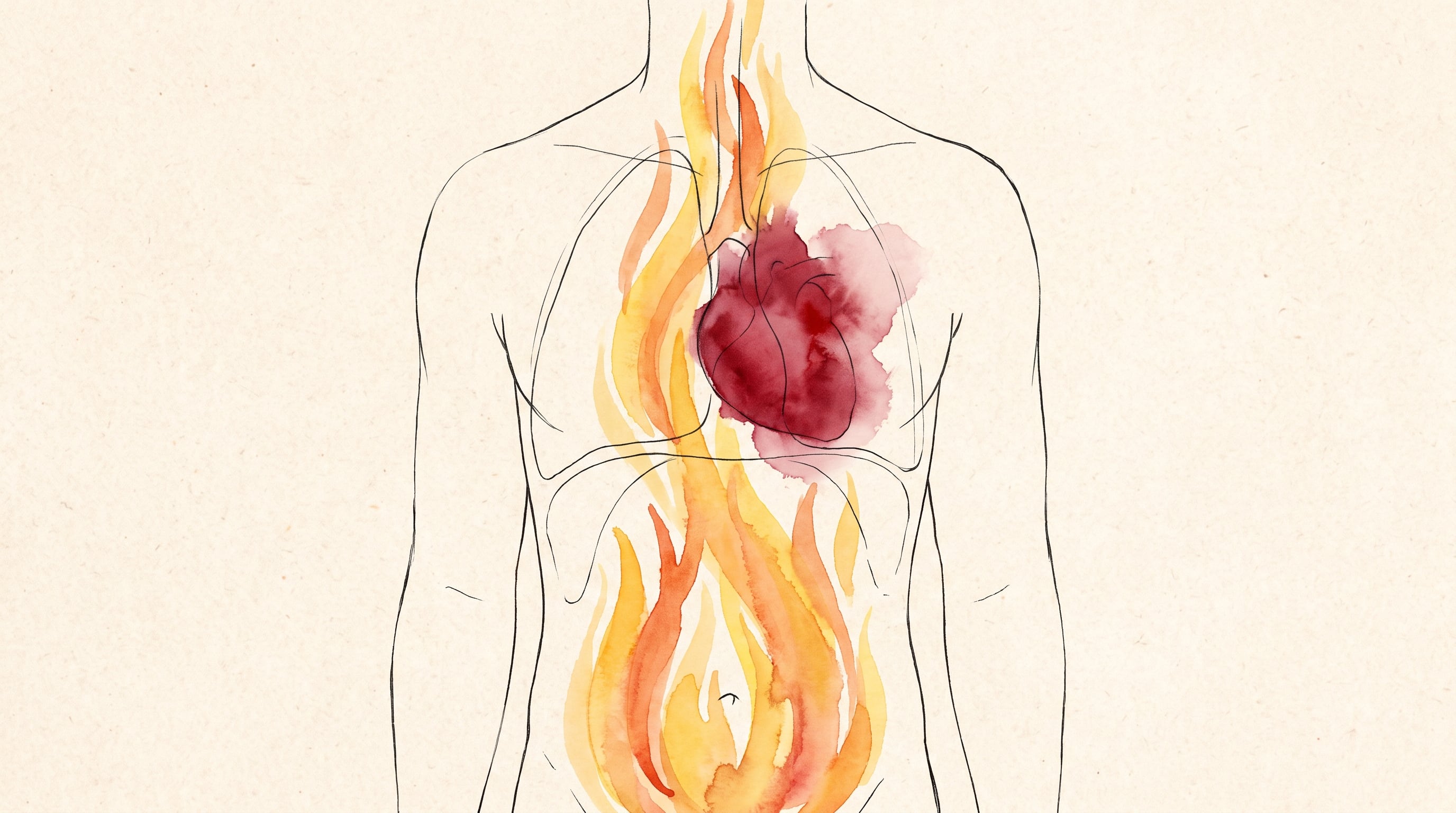 Un estudio con más de un millón de participantes asoció la enfermedad por reflujo gastroesofágico con un 27% más de riesgo de sufrir un infarto (Imagen Ilustrativa Infobae)