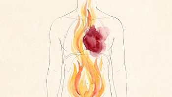 Un estudio sugiere un posible vínculo entre la acidez, el reflujo gástrico y un riesgo más elevado de infarto