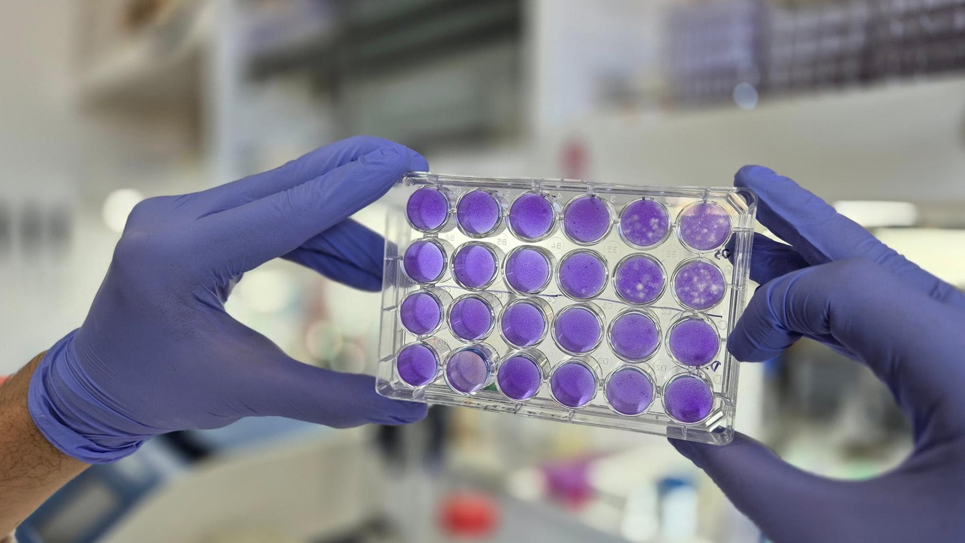 Científicos de la Fundación Instituto Leloir, el CONICET, la UBA y la Universidad de Toronto protagonizan el avance internacional contra los ortoflavivirus (FIL)