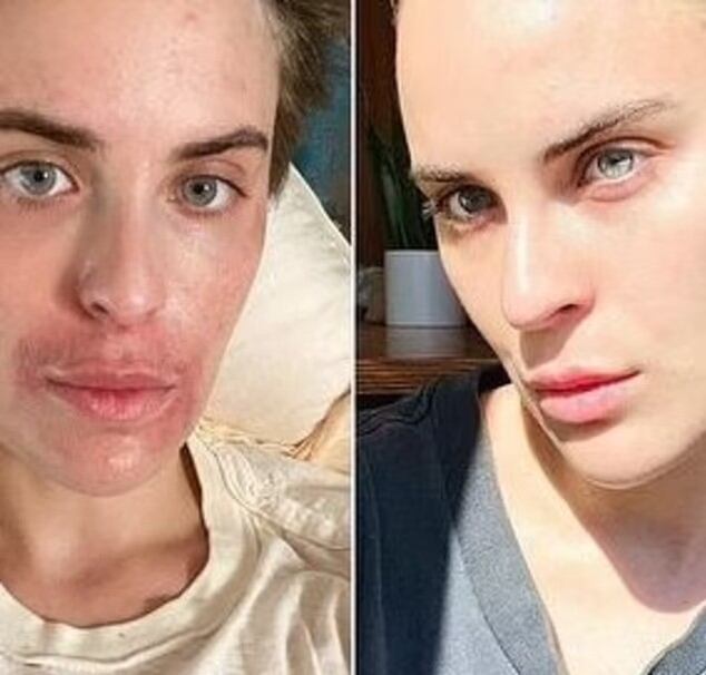 La actriz explicó que el camino de recuperación está hecho de “pequeñas victorias”.(Instagram/buuski)