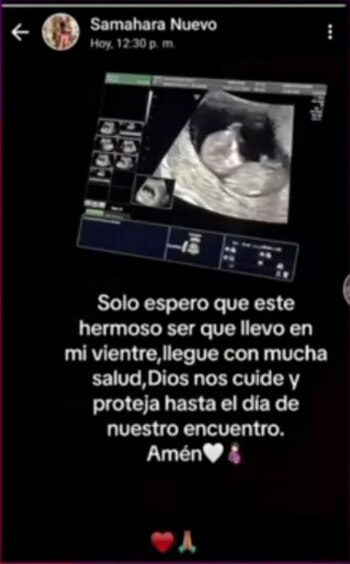 Samahara Lobatón anuncia embarazo y