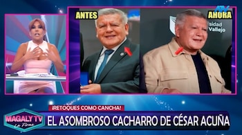 ¿Qué se habría hecho César Acuña en el rostro? Magaly Medina reacciona y especialistas analizan su apariencia. Captura: Magaly TV La Firme.