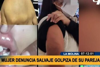 La gresión fue al interior