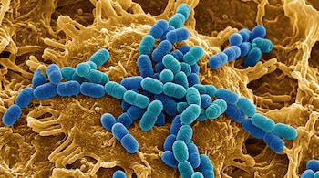 Bacterias ovaladas de color azul y turquesa agrupadas sobre una superficie celular rugosa de color dorado.