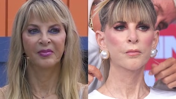 Shanik Berman presume “nuevo rostro” en televisión tras ponerse hilos tensores en vivo