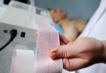 Una mano sostiene un papel milimetrado impreso con un trazado cardíaco junto a un electrocardiógrafo y un paciente desenfocado