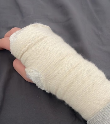 Garçom que sofreu acidente de trabalho foi demitido (@SoyCamarero/X)