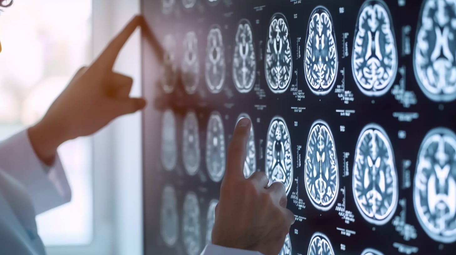 Algunos antiinflamatorios presentan efectos adversos graves, lo que limita su uso regular en el tratamiento de la depresión con inflamación (Imagen Ilustrativa Infobae)