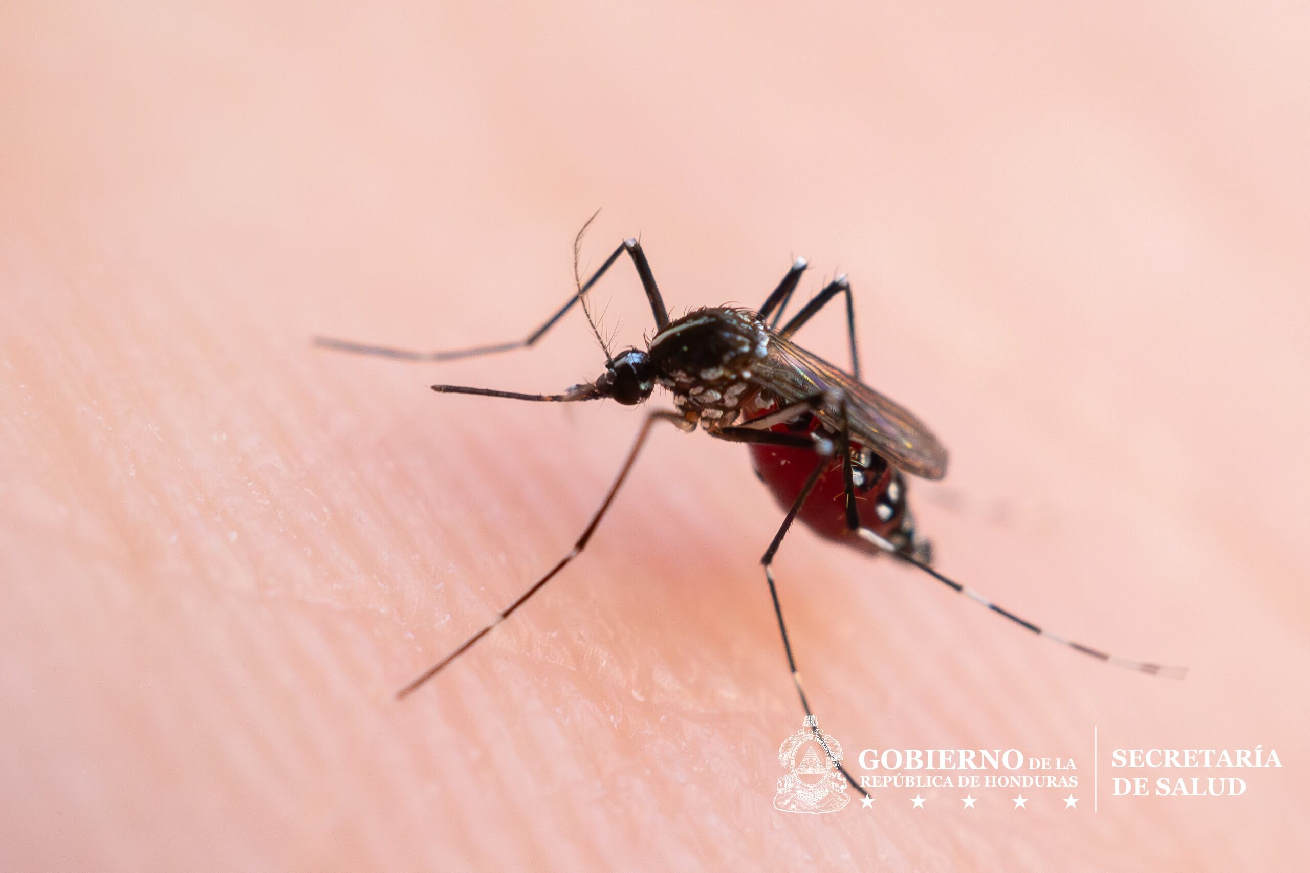 La Secretaría de Salud confirmó dos nuevas muertes por dengue grave en el departamento de Choluteca. Las víctimas son una adolescente de 16 años y una niña de seis años. (Foto: Secretaria de Salud)