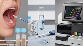 Boca abierta con cepillo tomando muestra, dos tubos de recolección, un tubo de ensayo con partículas, micropipeta, placa de PCR y equipo de qPCR con pantalla de gráficos.