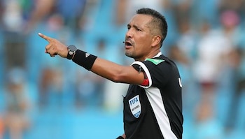 Miguel Santivañez nunca más podrá