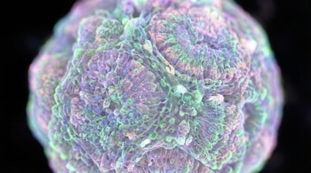 Primer plano de un organoide cerebral esférico, mostrando una superficie muy texturizada con tonalidades púrpuras, verdes y rosadas sobre un fondo negro.