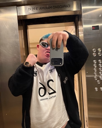 “Alonso” superó el millón de seguidores, enfrenta al bullying y las redes lo adoran: de personaje viral a perfilarse como artista