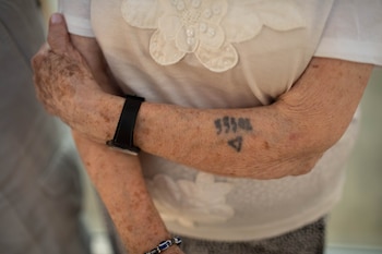 El brazo de Lea Zajak