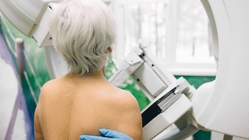Menos sobrediagnóstico en el cribado de cáncer de mama de lo que se pensaba, según un estudio